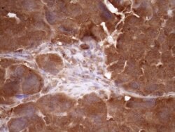 FSCN1 Monoclonal Antibody (OTI3B4), TrueMAB , OriGene 100 μL; Unconjugated:Antibodies,