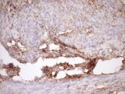 FSCN1 Monoclonal Antibody (OTI3B4), TrueMAB , OriGene 100 μL; Unconjugated:Antibodies,