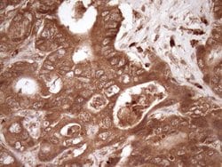 FSCN1 Monoclonal Antibody (OTI3B4), TrueMAB , OriGene 100 μL; Unconjugated:Antibodies,