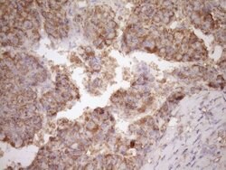 FSCN1 Monoclonal Antibody (OTI3B4), TrueMAB , OriGene 100 μL; Unconjugated:Antibodies,