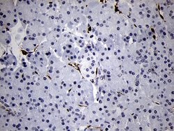 FSCN1 Monoclonal Antibody (OTI3D2), TrueMAB , OriGene 100 μL; Unconjugated:Antibodies,
