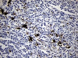 FSCN1 Monoclonal Antibody (OTI3D2), TrueMAB , OriGene 100 μL; Unconjugated:Antibodies,