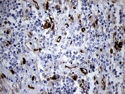 FSCN1 Monoclonal Antibody (OTI3D2), TrueMAB , OriGene:Antibodies:Primary