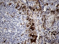 FSCN1 Monoclonal Antibody (OTI3D2), TrueMAB , OriGene 100 μL; Unconjugated:Antibodies,