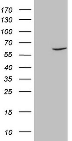FSCN1 Monoclonal Antibody (OTI3B4), TrueMAB , OriGene:Antibodies:Primary