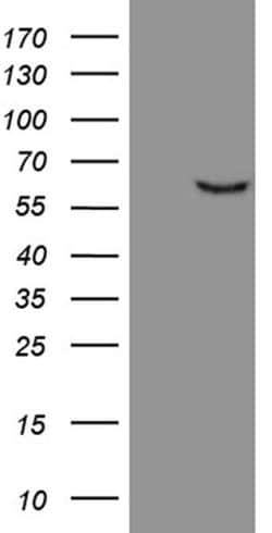 FSCN1 Monoclonal Antibody (OTI2C3), TrueMAB , OriGene 100 &mu;L; Unconjugated:Antibodies,