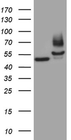 FSCN1 Monoclonal Antibody (OTI3D2), TrueMAB , OriGene 100 μL; Unconjugated:Antibodies,
