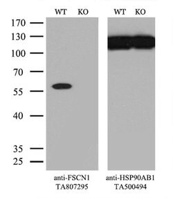 FSCN1 Monoclonal Antibody (OTI3D2), TrueMAB , OriGene 100 μL; Unconjugated:Antibodies,