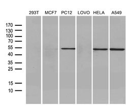 FSCN1 Monoclonal Antibody (OTI3D2), TrueMAB , OriGene 100 μL; Unconjugated:Antibodies,