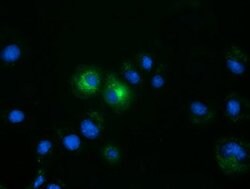 FSHB Mouse anti-Human, Clone: OTI2A6, lyophilized, TrueMAB 100 &mu;g; Unconjugated:Antibodies,
