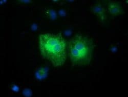 FSHB Monoclonal Antibody (OTI4B9), TrueMAB , OriGene 30 &mu;L; Unconjugated:Antibodies,