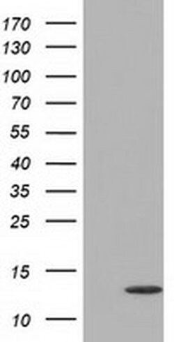FSHB Monoclonal Antibody (OTI4E10), TrueMAB , OriGene:Antibodies:Primary