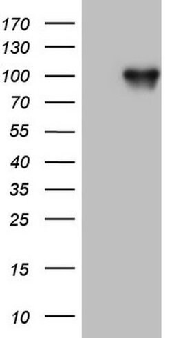 FSIP1 Monoclonal Antibody (OTI2F6), TrueMAB , OriGene 100 &mu;L; Unconjugated:Antibodies,