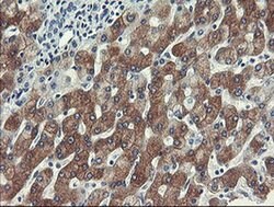 FTCD Monoclonal Antibody (OTI1A7), TrueMAB , OriGene 30 &mu;L; Unconjugated:Antibodies,