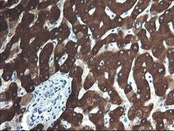 FTCD Mouse anti-Human, Clone: OTI4F5, lyophilized, TrueMAB 100 &mu;g; Unconjugated:Antibodies,