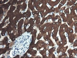 FTCD Monoclonal Antibody (OTI4F5), TrueMAB , OriGene 100 &mu;L; Unconjugated:Antibodies,