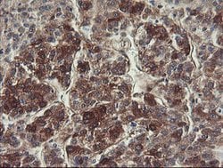 FTCD Mouse anti-Human, Clone: OTI4F5, lyophilized, TrueMAB 100 &mu;g; Unconjugated:Antibodies,