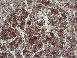 FTCD Monoclonal Antibody (OTI4F5), TrueMAB , OriGene 100 &mu;L; Unconjugated:Antibodies,