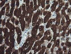 FTCD Monoclonal Antibody (OTI8C2), TrueMAB , OriGene 100 &mu;L; Unconjugated:Antibodies,