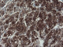 FTCD Mouse anti-Human, Clone: OTI8C2, lyophilized, TrueMAB 100 &mu;g; Unconjugated:Antibodies,