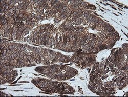 FTCD Monoclonal Antibody (OTI4A7), TrueMAB , OriGene 30 &mu;L; Unconjugated:Antibodies,