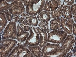 FTCD Monoclonal Antibody (OTI4A7), TrueMAB , OriGene 30 &mu;L; Unconjugated:Antibodies,