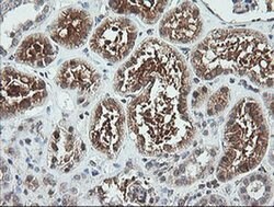 FTCD Monoclonal Antibody (OTI4A7), TrueMAB , OriGene 30 &mu;L; Unconjugated:Antibodies,