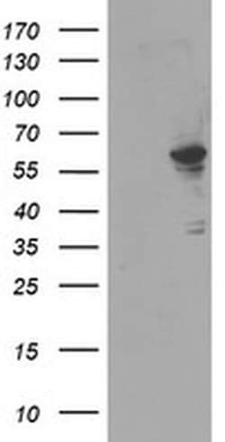FTCD Monoclonal Antibody (OTI7C5), TrueMAB , OriGene 30 &mu;L; Unconjugated:Antibodies,