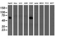 FTCD Monoclonal Antibody (OTI7C5), TrueMAB , OriGene 30 &mu;L; Unconjugated:Antibodies,