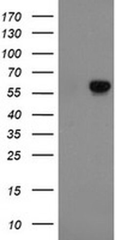 FTCD Monoclonal Antibody (OTI1A7), TrueMAB , OriGene 30 &mu;L; Unconjugated:Antibodies,