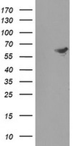 FTCD Monoclonal Antibody (OTI4C3), TrueMAB , OriGene 100 &mu;L; Unconjugated:Antibodies,