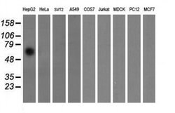 FTCD Monoclonal Antibody (OTI4C3), TrueMAB , OriGene 100 &mu;L; Unconjugated:Antibodies,