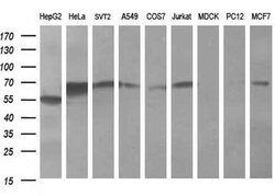 FTCD Monoclonal Antibody (OTI4B6), TrueMAB , OriGene:Antibodies:Primary