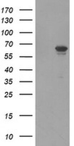 FTCD Monoclonal Antibody (OTI2B12), TrueMAB , OriGene 100 &mu;L; Unconjugated:Antibodies,