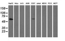 FTCD Monoclonal Antibody (OTI2B12), TrueMAB , OriGene 100 &mu;L; Unconjugated:Antibodies,