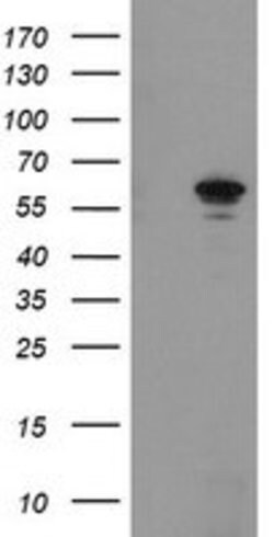 FTCD Mouse anti-Human, Clone: OTI4F5, lyophilized, TrueMAB 100 &mu;g; Unconjugated:Antibodies,