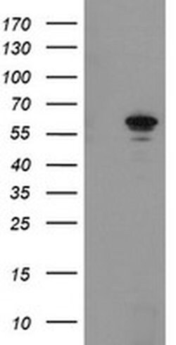 FTCD Monoclonal Antibody (OTI4F5), TrueMAB , OriGene 100 &mu;L; Unconjugated:Antibodies,