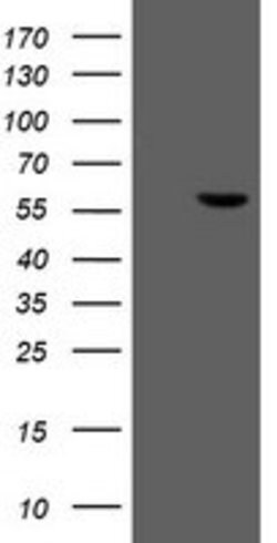 FTCD Mouse anti-Human, Clone: OTI8C2, lyophilized, TrueMAB 100 &mu;g; Unconjugated:Antibodies,