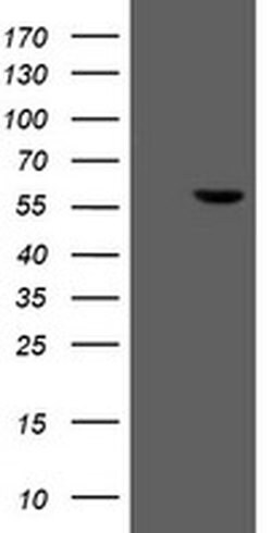 FTCD Monoclonal Antibody (OTI8C2), TrueMAB , OriGene 100 &mu;L; Unconjugated:Antibodies,