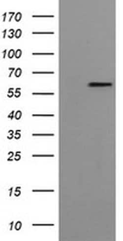 FTCD Monoclonal Antibody (OTI4A7), TrueMAB , OriGene 30 &mu;L; Unconjugated:Antibodies,