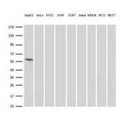 FTCD Monoclonal Antibody (OTI4A7), TrueMAB , OriGene 30 &mu;L; Unconjugated:Antibodies,