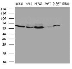 FTO Mouse anti-Human, Clone: OTI4A1, lyophilized, TrueMAB 100 &mu;g; Unconjugated:Antibodies,