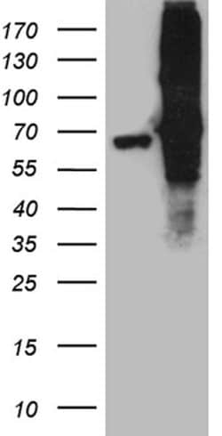 FUBP3 Monoclonal Antibody (OTI9B2), TrueMAB , OriGene 30 &mu;L | Buy Online | Origene Technologies | Fisher Scientific