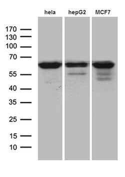 FUBP3 Monoclonal Antibody (OTI9B2), TrueMAB , OriGene 30 &mu;L | Buy Online | Origene Technologies | Fisher Scientific
