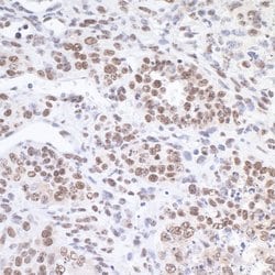 FUS Rabbit anti-Human, Mouse, Polyclonal, Bethyl Laboratories 100 &mu;L;