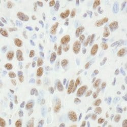 FUS Polyclonal Antibody, Bethyl Laboratories:Antibodies:Primary Antibodies