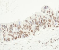 FUS Polyclonal Antibody, Bethyl Laboratories 100 &mu;L; Unconjugated:Antibodies,