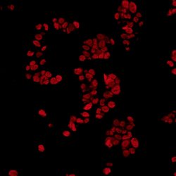 FUS Recombinant Rabbit Monoclonal Antibody (BLR023E), Bethyl Laboratories