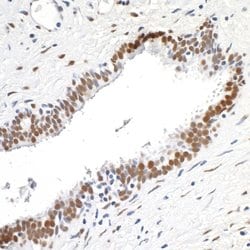 FUS Recombinant Rabbit Monoclonal Antibody (BLR023E), Bethyl Laboratories