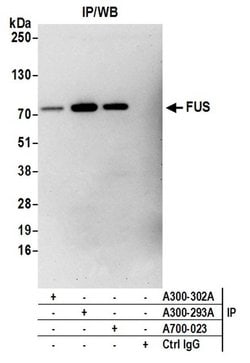 FUS Recombinant Rabbit Monoclonal Antibody (BLR023E), Bethyl Laboratories